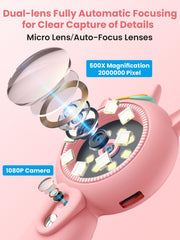 Acoath auto-focus system reduces blur for clear observations.