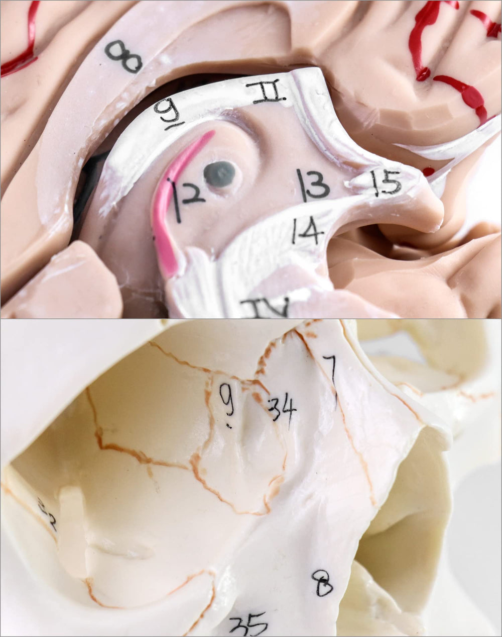 QWORK brain model with 32 numeric markers supports labeled navigation.