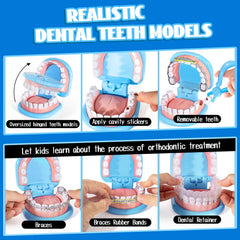 ULOVEME oversized teeth model with removable teeth for practice extractions and dental scenario builds at home.
