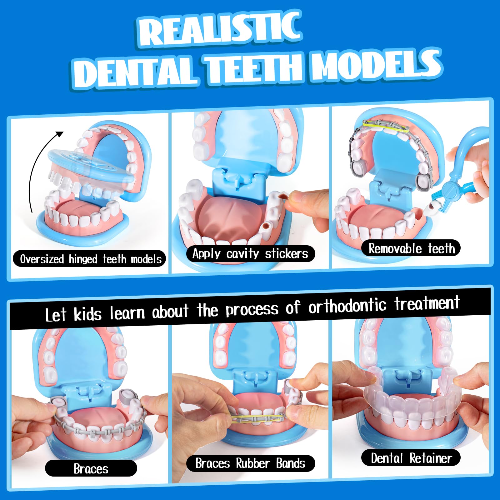 ULOVEME oversized teeth model with removable teeth for practice extractions and dental scenario builds at home.