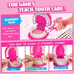 ULOVEME Removable teeth model for practicing extractions safely